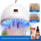 Dispositivo Laser Funcional Para Unhas
