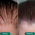 Paralisa a Queda e Acelera o Crescimento Capilar - Growth Hair